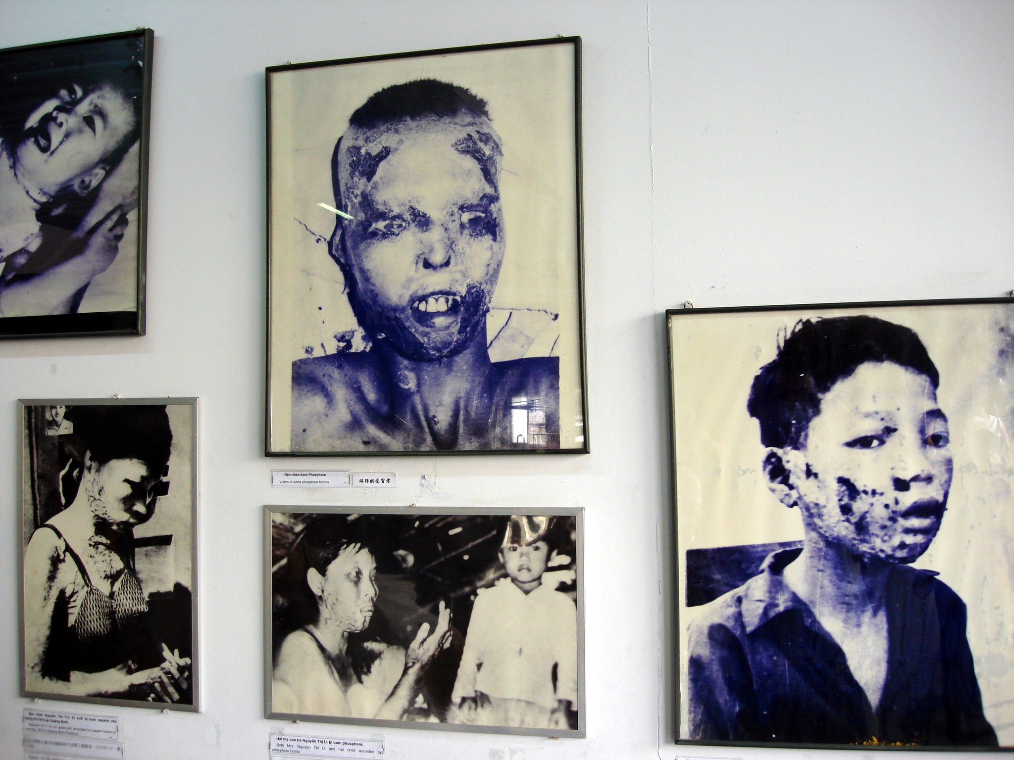 Vietnamese Still Uncompensated for Agent-Orange